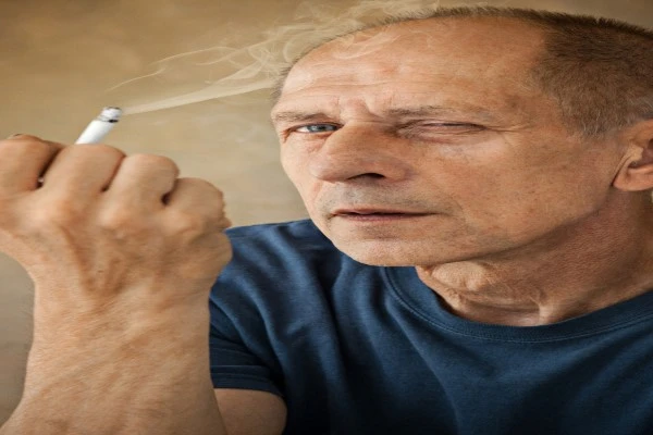 Tobacco And Alopecia, Are They Related? 1 Tobacco And Alopecia, Are They Related?