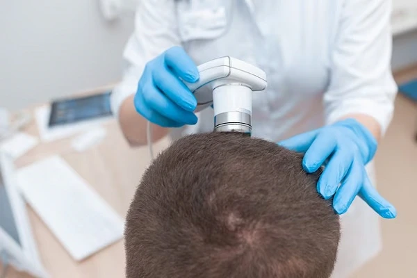 Nanotechnology against hair loss 3 Nanotechnology against hair loss