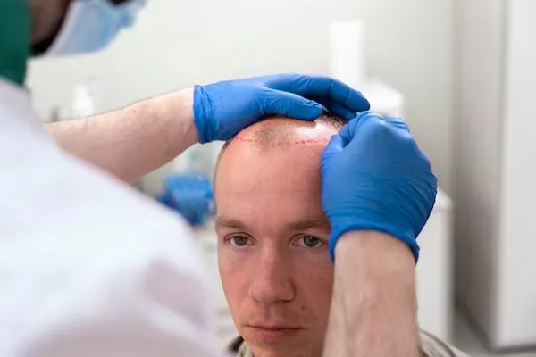 Is it possible to know if a hair transplant will work?