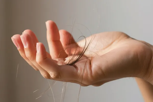 How Many Hairs Fall Out a Day? How Much Falling Is Too Much? 1 How Many Hairs Fall Out a Day? How Much Falling Is Too Much?
