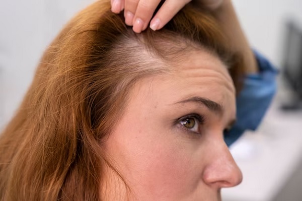 Hair with little volume: how to increase it 3 Hair with little volume: how to increase it