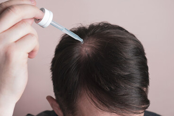 Non-Surgical Alternatives to Hair Transplant 3 Non-Surgical Alternatives to Hair Transplant