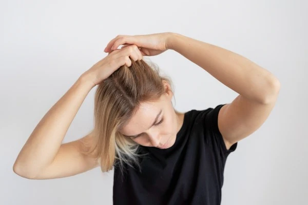 Minoxidil Itching, what to do?