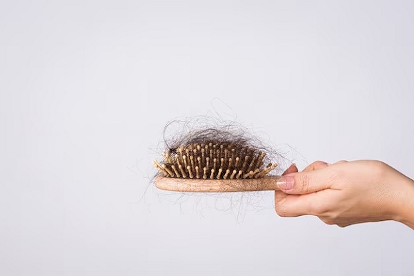 My hairs falling out: What do I do?