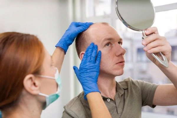 3 months Post Hair Transplant