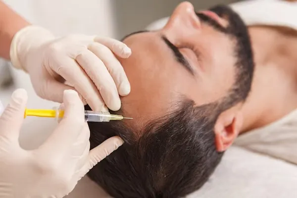 FAQs about hair transplant: All you need to know