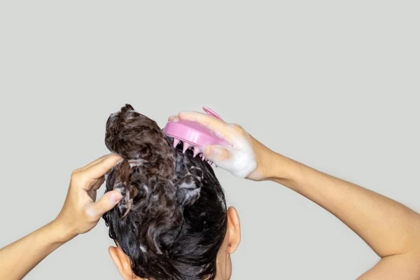 Scalp Changes and Treatments 2 Scalp Changes and Treatments