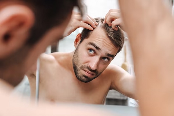 How to recover lost hair? 3 How to recover lost hair?