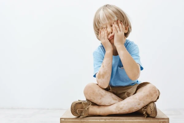 Waardenburg Syndrome 1 Waardenburg Syndrome