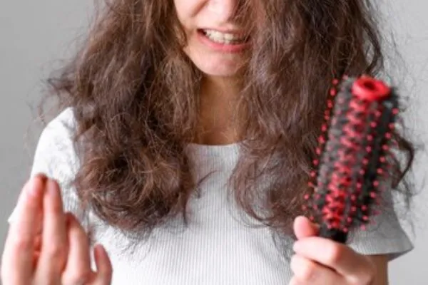 Women Hair Transplant