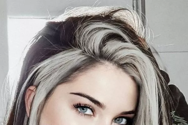 Poliosis in the hair: What about children?
