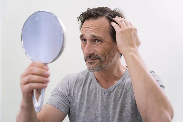 Will I Overcome Baldness When I Start Experiencing Gray Hair? 2 Will I Overcome Baldness When I Start Experiencing Gray Hair?