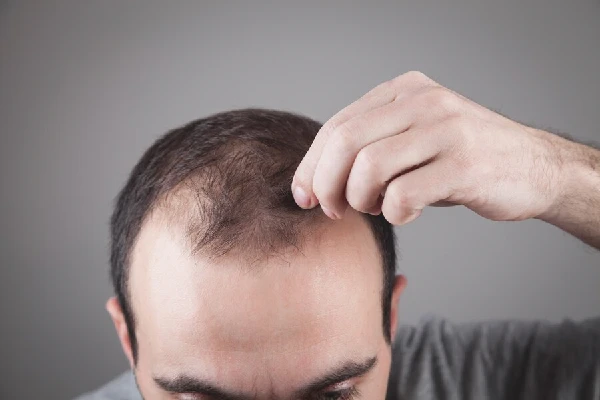 Hair with little volume: how to increase it 1 Hair with little volume: how to increase it