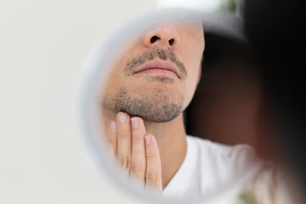 What Is Beard Alopecia? 4 What Is Beard Alopecia?