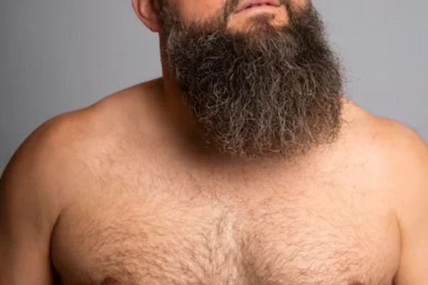 Does the Donor Area Grow Back After a Hair Transplant? 3 Does the Donor Area Grow Back After a Hair Transplant?
