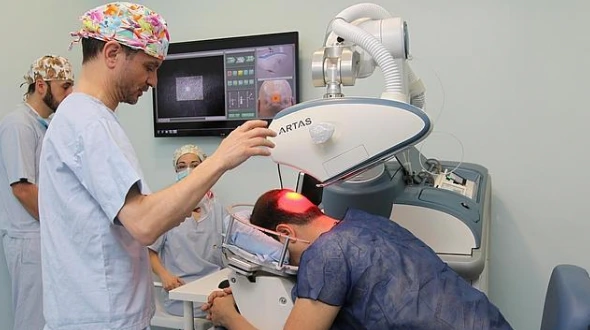 Hair implants, are they effective? 1 Hair implants, are they effective?