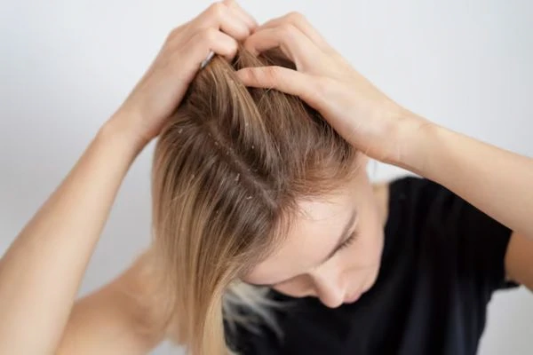 Psoriasis: Symptoms, Causes, and Treatments 3 Psoriasis: Symptoms, Causes, and Treatments