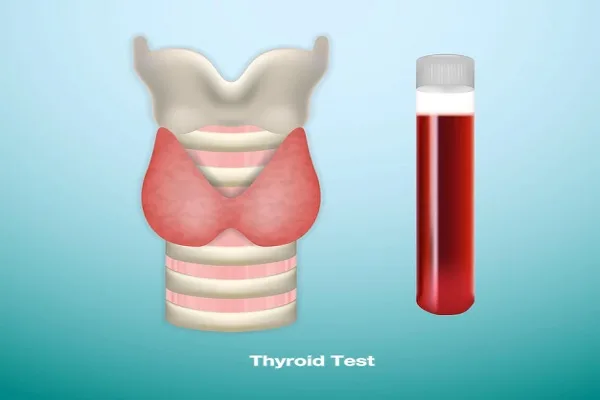 Tests to diagnose Alopecia 1 Tests to diagnose Alopecia