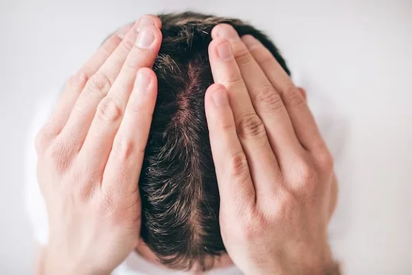 Tests to diagnose Alopecia 7 Tests to diagnose Alopecia