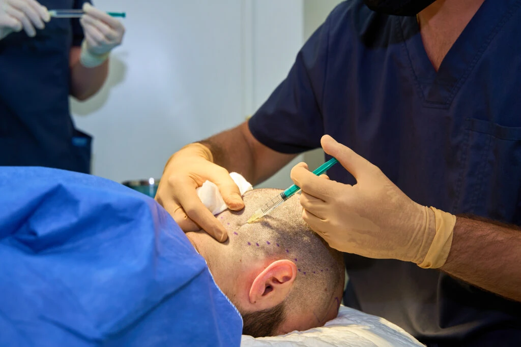 Who is the best hair transplant doctor in the world? 2 Who is the best hair transplant doctor in the world?