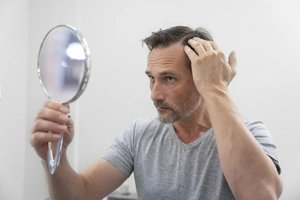 Hair transplant for bald people