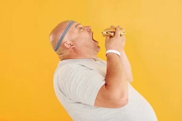 Hair Loss and Obesity: How are they related? 1 Hair Loss and Obesity: How are they related?