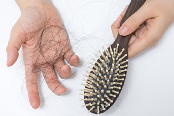 I lose a lot of hair: is it normal or not?