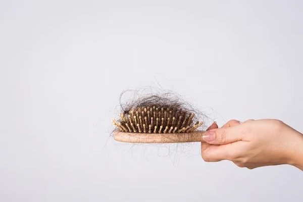Vitamin Deficiency and Hair Loss 2 Vitamin Deficiency and Hair Loss