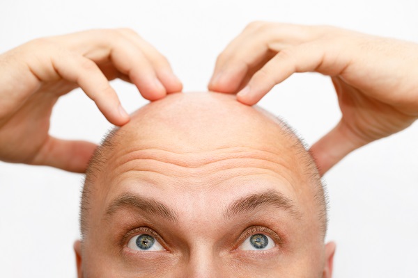 Non-Surgical Alternatives to Hair Transplant 1 Non-Surgical Alternatives to Hair Transplant