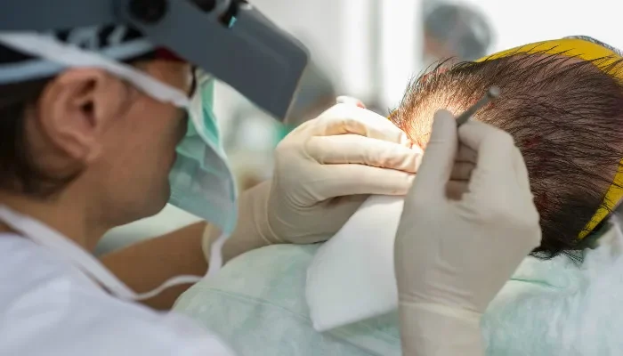 Turkey hair transplant: At the forefront of the world