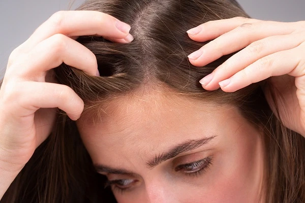 Hairstyles That Cover Your Frontal Alopecia