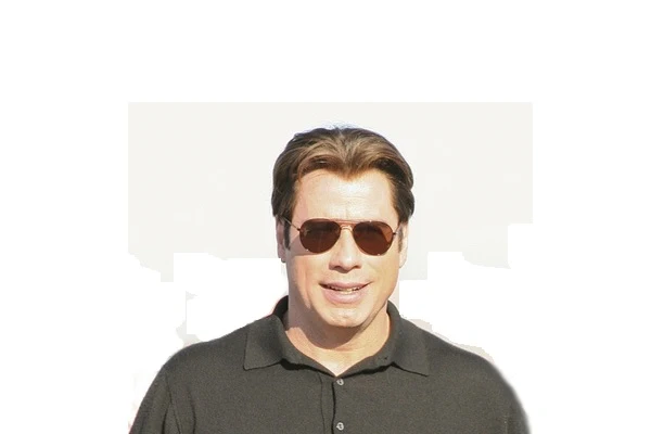 Famous people with hair transplant 2 Famous people with hair transplant