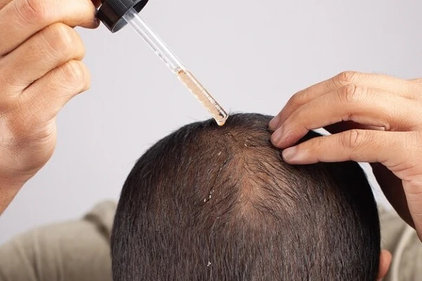 What is a hair regenerator and where to find it?