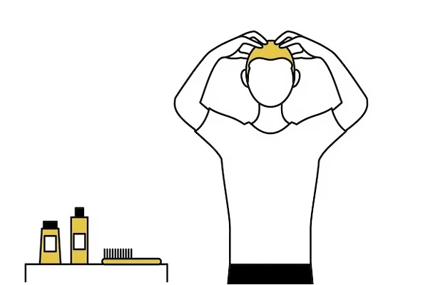 Minoxidil 5, what is it and how to use it to stop hair loss? 5 Minoxidil 5, what is it and how to use it to stop hair loss?