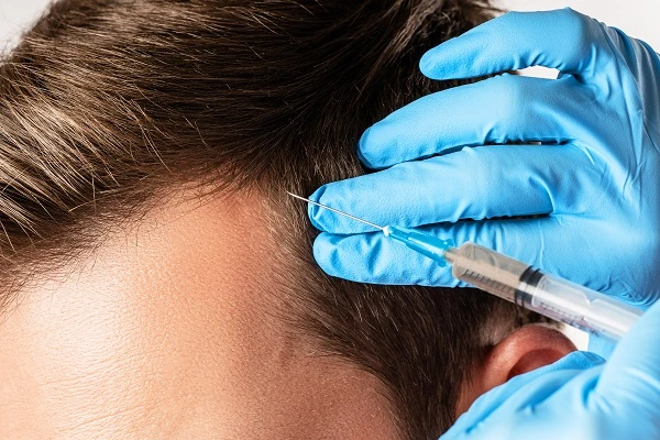 Platelet-rich Plasma Therapy, Everything You Should Know