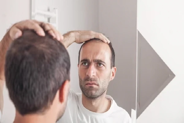 Is there a cure for baldness?