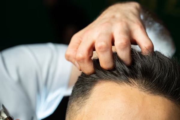 Scalp Massage and Its Benefits 2 Scalp Massage and Its Benefits