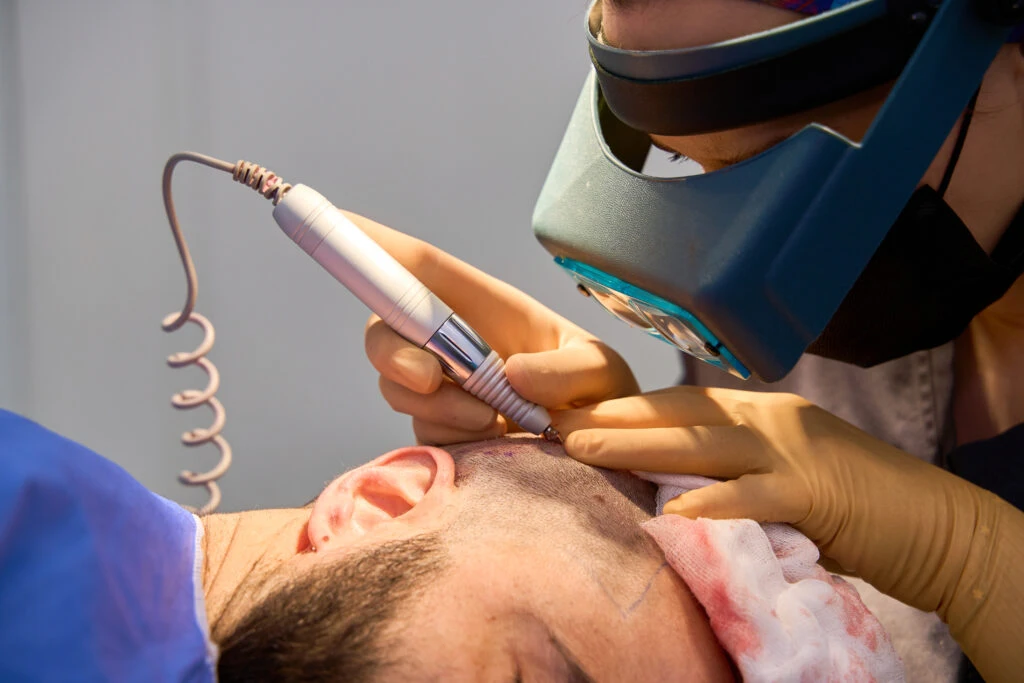 Who is the best hair transplant doctor in the world? 3 Who is the best hair transplant doctor in the world?