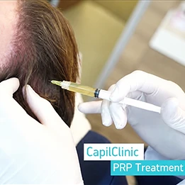 Hair Transplant in Turkey -Capilclinic - PRP Treatment
