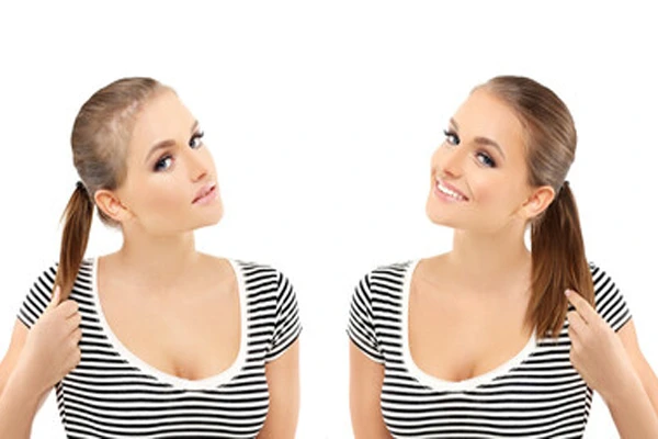 Frontal Fibrosing Alopecia: What Are Its Causes? 4 Frontal Fibrosing Alopecia: What Are Its Causes?