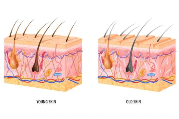 Hair Follicle Structure and its associated Diseases 5 Hair Follicle Structure and its associated Diseases