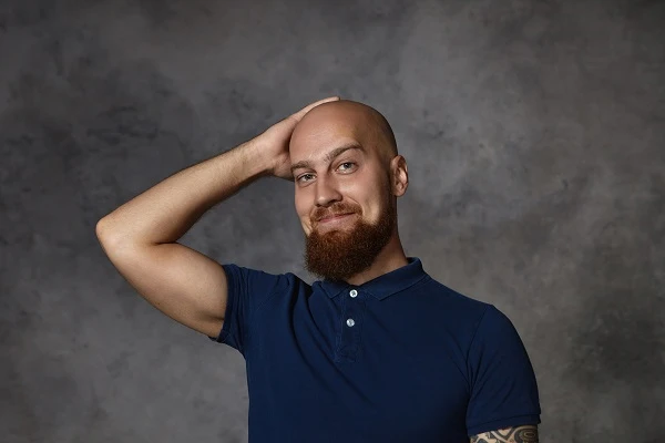 If You’re Below 30 And You’re Already Growing Bald, Read This 1 If You’re Below 30 And You’re Already Growing Bald, Read This