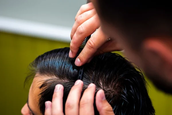 Trasplante capilar FUE de pelo largo