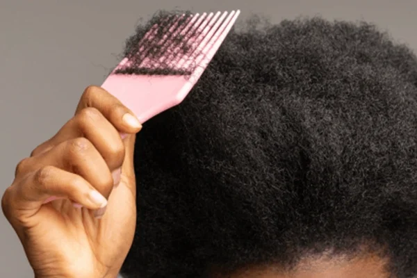 Afro Hair Transplant