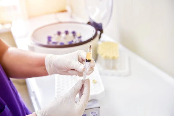 Time to expect results after PRP Treatment for hair loss