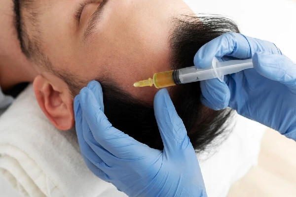 Time to expect results after PRP Treatment for hair loss