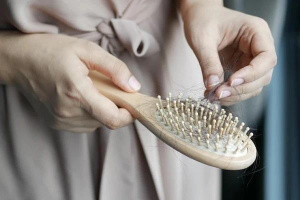 Relationship between Polycystic Ovary Syndrome and hair loss 4 Relationship between Polycystic Ovary Syndrome and hair loss