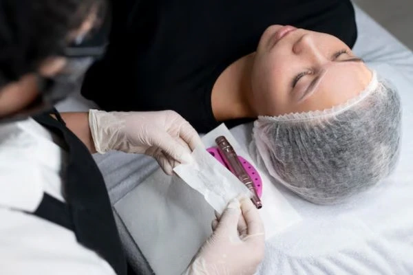 What is Capillary Micropigmentation: Treatments