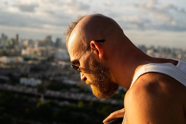 Summer and Baldness, are they related? 2 Summer and Baldness, are they related?