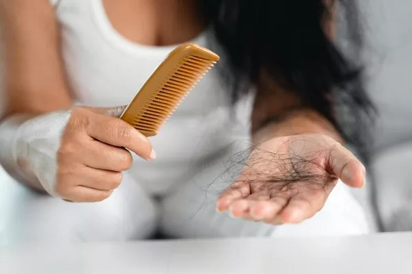 Alopecia In Menopause 3 Alopecia In Menopause